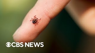 Meat allergy caused by ticks are on the rise, CDC says