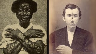 15 Disturbing Human Circus Freaks That Actually Exist