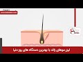 لیزر موهای زائد فیلم لیزر موهای زائد کلینیک پوست و مو هلیا شماره 18 
