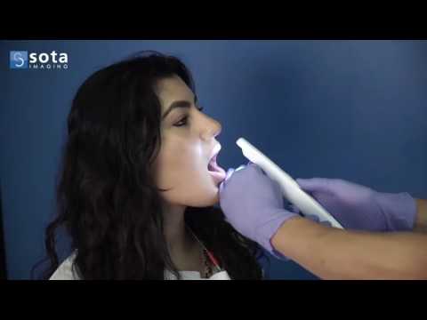 claris®-i4d-intraoral-camera-–-how-to-take-crystal-clear-images