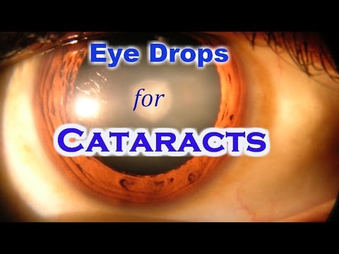 Video: Treatment Of Eye Cataracts Without Surgery