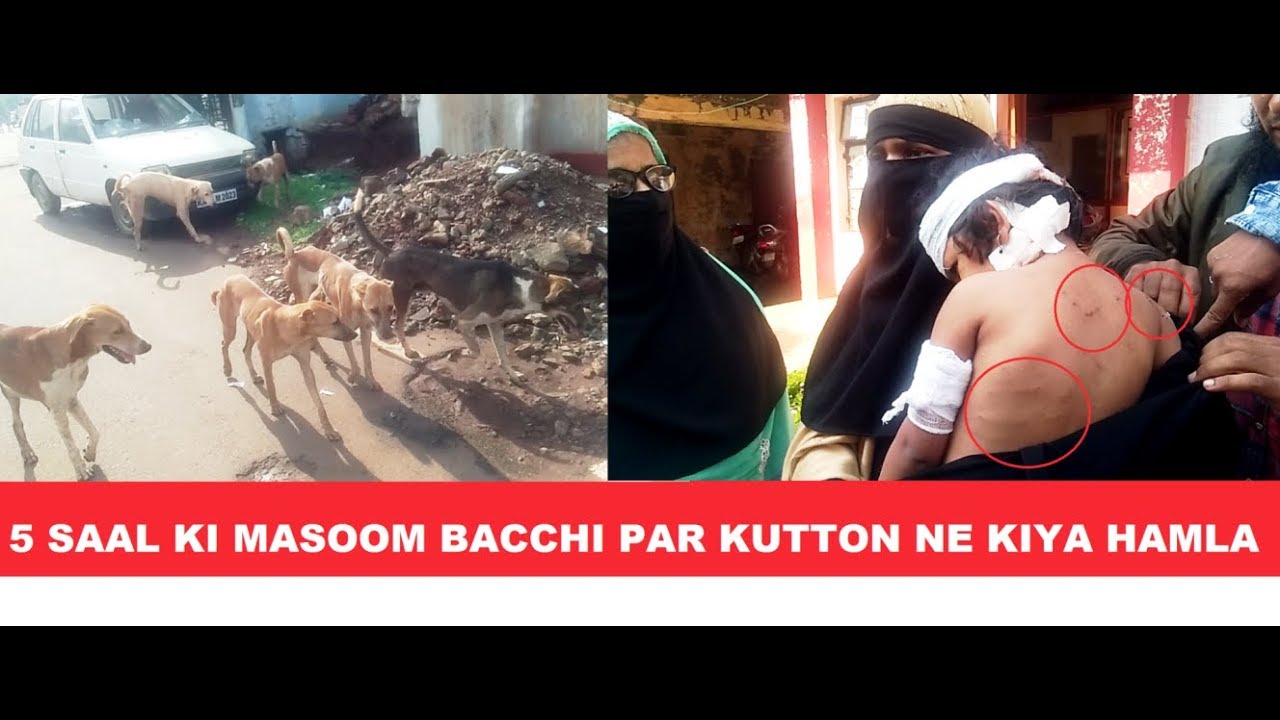 5 SAAL KI MASOOM BACCHI PAR KUTTON NE KIYA HAMLA / EYLAAPH NEWS