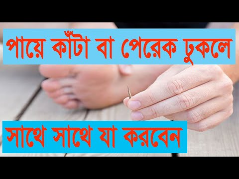 ভিডিও: অন্ধদের কীভাবে সাহায্য করবেন (ছবি সহ)