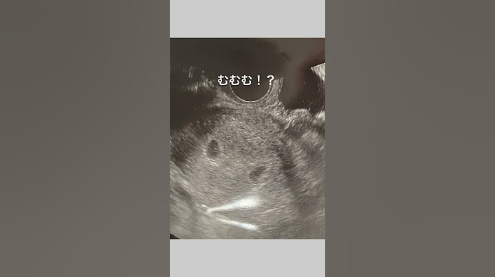 【ご報告】3才の双子の下に生まれるのは、、、またもや双子！？