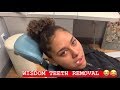 ALICIA GETS HERS WISDOM TEETH REMOVED (FUNNY!) | MONTES TWINS |