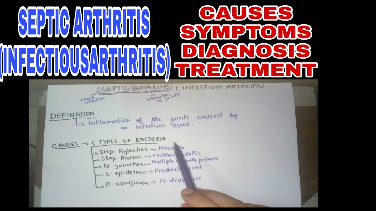 SEPTIC ARTHRITIS Causes,Symptoms,Diagnosis,Treatment YouTube