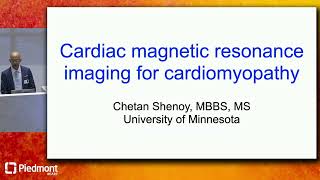 Cardiac Magnetic Resonance Imaging in Cardiomyopathy