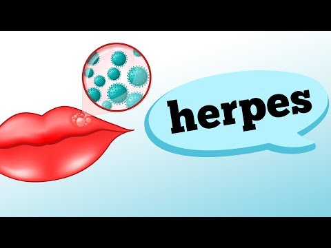 Vídeo: Como prevenir a infecção de herpes labial: 9 etapas (com fotos)