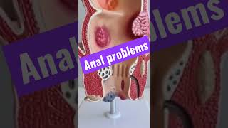 Pain And Problems I Surat I Mumbai I Indore I India