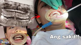 I GOT BRACES🦷!! FOR THE FIRST TIME (MY EXPERIENCE+PAIN) VLOG..... screenshot 4