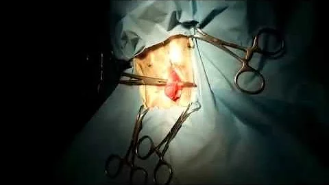 Cosa fare dopo ovariectomia?
