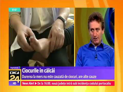 Dureri de talpa si calcai, pinten (cioc) calcaneu: Marius Uscatu, Institutul Piciorului