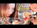 【耳かき】耳毛剃り/耳掃除 -総集編- ベトナム式 理髪店 Ear Cleaning/Ear Shave ASMR