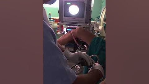 Cystoscopy