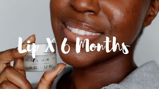 I Tried Dr V Lip X Kit - 6 Month Update | Lakisha Adams