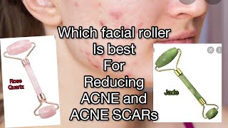 Which FACIAL ROLLER is best for REDUCING ACNE and ACNE SCAR. facial rollers reduce PIMPLES?