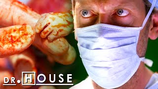 Un feto toma el dedo de House | Dr. House: Diagnóstico Médico