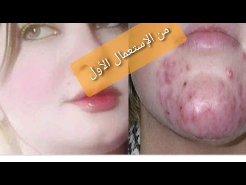 السلام عليكم حبيباتي اتمنى ان تكونوا بخير ** لا تنسوا الاشتراك في قناتي مع تفعيل الجرس ليصلكم كل جدي. 