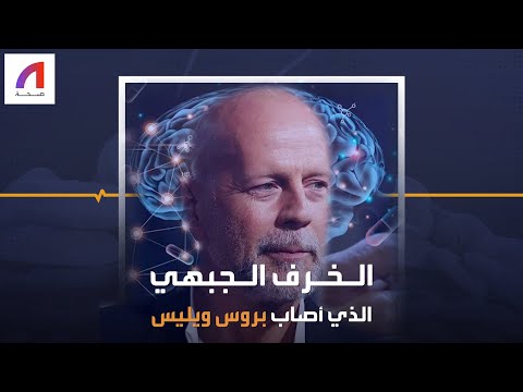 فيديو: هل يقتلك الخرف الجبهي الصدغي؟