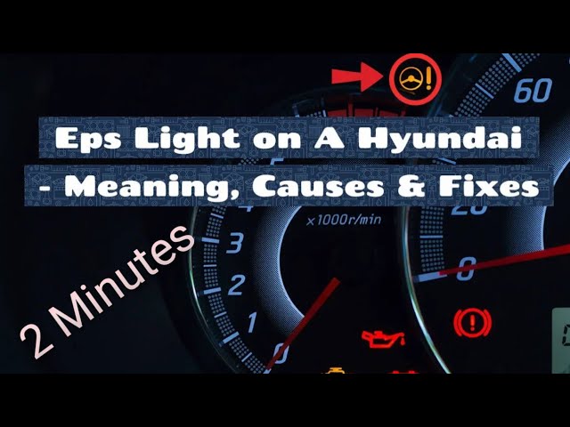 Eps Warning Light Hyundai Elantra | Shelly Lighting