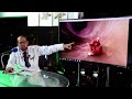 حصوات الكلي وحصوات المرارة   دكتور جودة محمد عواد