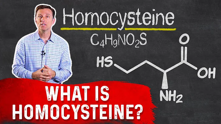 What Is Homocysteine?  Dr. Berg