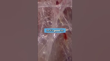 Understanding Fascia: The Fluid Matrix of Our Bodies #anatomicalgangster #scarhealing #energy
