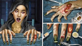 ASMR Zombie! Treatment for deformed hands and ingrown nail !