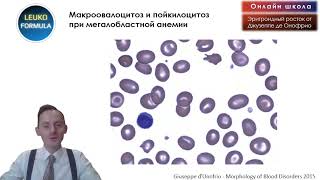 Морфология анемий из Италии.  2 часть. Трейлер.