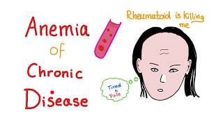 Anemia of Chronic Disease, All you need to know!