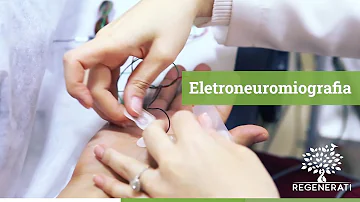 Como é feito o exame eletroneuromiografia da face?