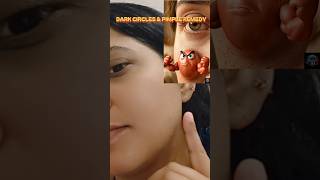 Crazyyy Hacks - Part 2 | AI Solutions ✨#darkcircles #pimple #acnetreatment #aivideo #trending