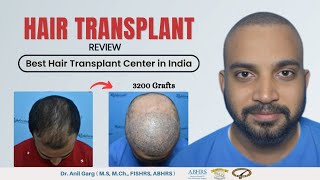 Hair transplant in indore | Best hair transplant results indore | Hair Transplant Cost in Indore |