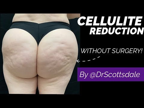 Better Sex Life — Dr. Scottsdale® Q&A testimonial