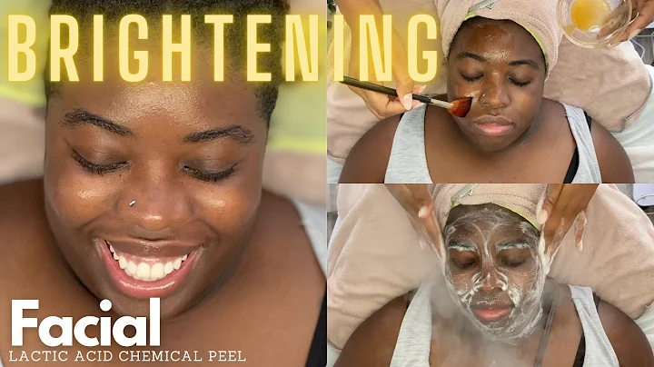 Chemical Peel | 20% Lactic Acid | Professional Facial