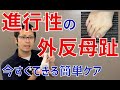 進行性の外反母趾はセルフケアで防ぐ方法　｜京都市北区　もり鍼灸整骨院