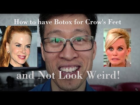 Video: Botox För Crow's Fötter: Biverkningar, Kostnader Och återhämtning