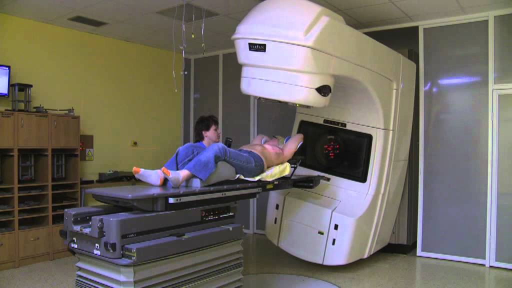 Léčba karcinomu prsu - radioterapie