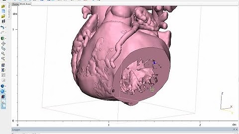 Tutorial: Mimics Innovation Suite - Add Myocardium to Your Heart Model