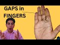 Do you have many gaps in your fingers  watch out 