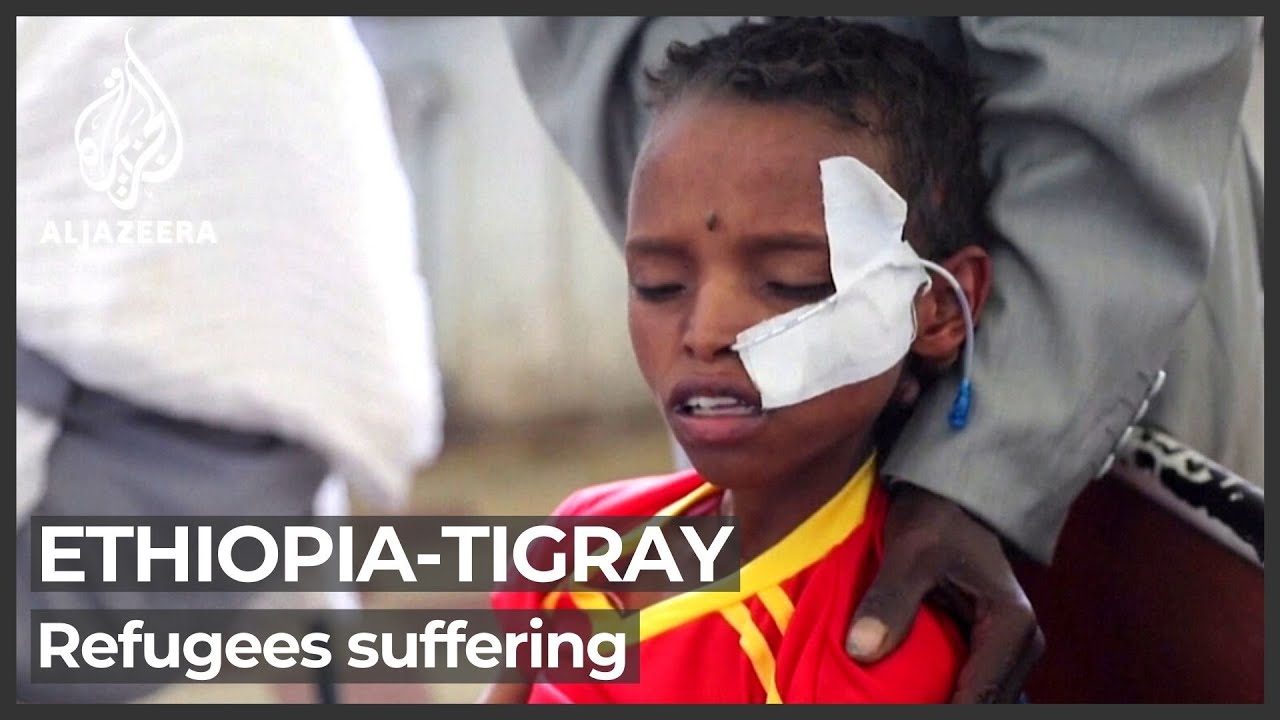 لاجئون تيغراي في السودان يعانون من سوء التغذية