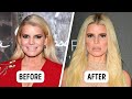 40 most incredible celebrities transformation