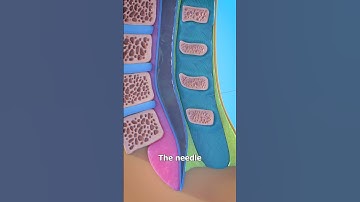 How A Spinal Tap Works 😨