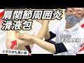 【有料級】肩関節治療の原点。滑液包の実技、痛みと可動域制限の原因は同じ?