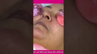 skin care _ عياده برفكت