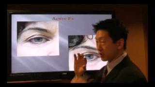 Part 1 Co2 Resurfacing, Active Fx, Deep Fx, Total Fx, Max Fx by Dr Young Seattle Bellevue Washington