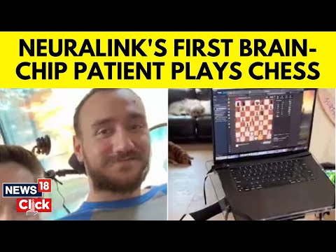 Elon Musks First Neuralink Brain Chip Patient Plays Chess Using Telepathy | English News | N18V