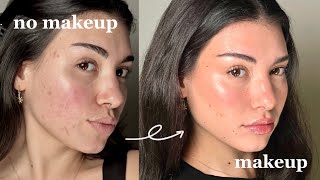 how to fake perfect skin with makeup | acne friendly