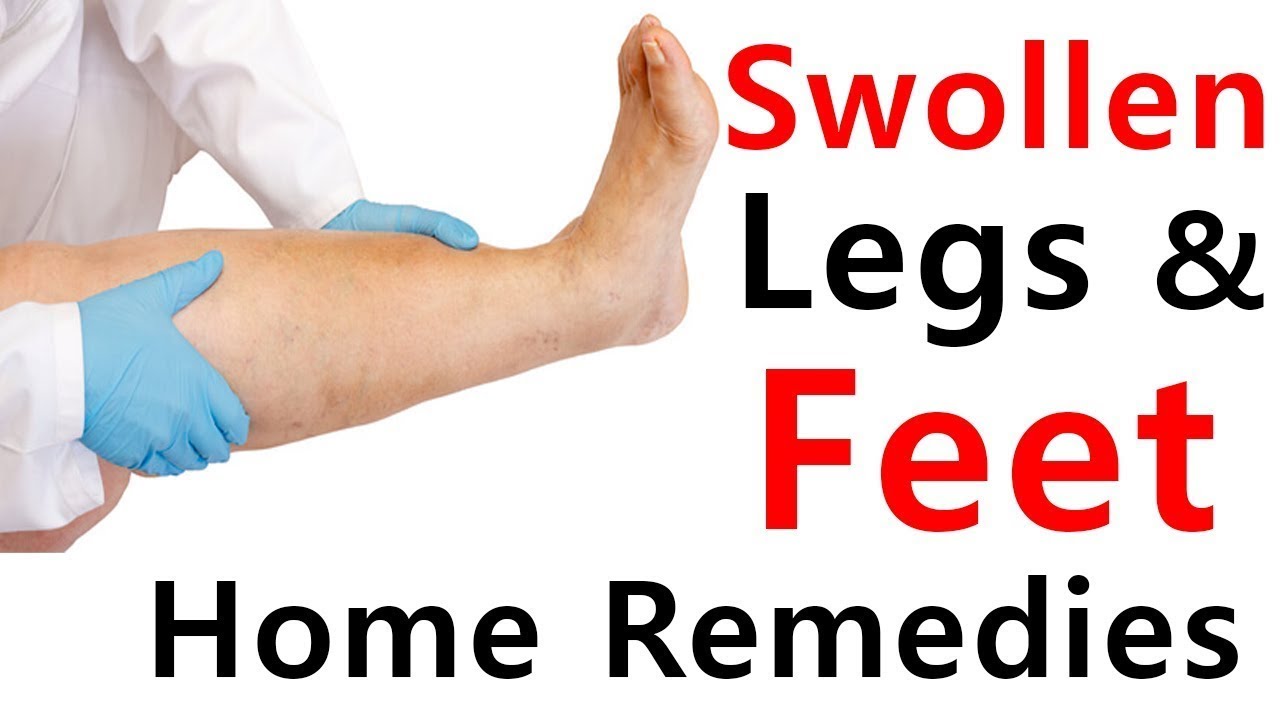 How to Get Rid of Swollen Feet Fast Natural Home