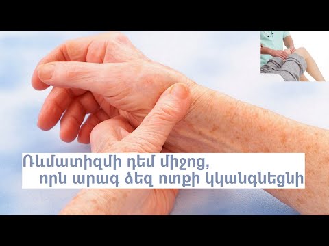 Video: Ռևմատիզմ